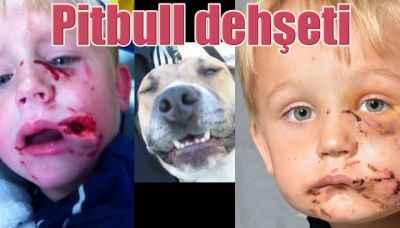 Pitbull dehşeti, Çocuğun yüzünü parçaladı