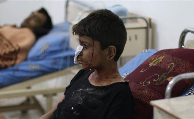 Doğu Guta'da yaralanan 12 yaşındaki Zigind: Yüzüm hep kan oldu, hastaneye koşmaya başladım