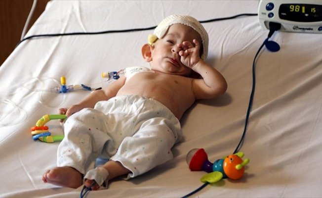 Suriyeli bebek, Türkiye'de sağlığına kavuştu