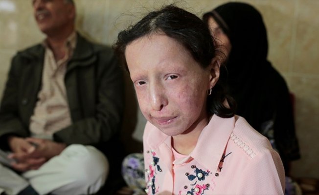 Nadir hastalığa yakalanan Suriyeli Zeve kardeşi gibi ölmek istemiyor