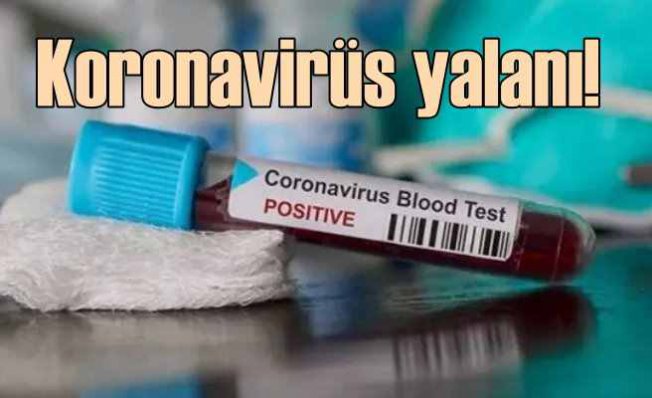 Koronavirüs için kan gurubunuza güvenmeyin | O bilgiler yalan