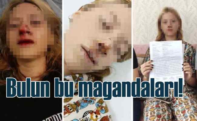 Sultangazi'de genç kıza maganda saldırısı Türkiye'yi ayağa kaldırdı