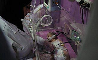 Yer altında ameliyatla kurtarılan bebeği kuşatma öldürdü
