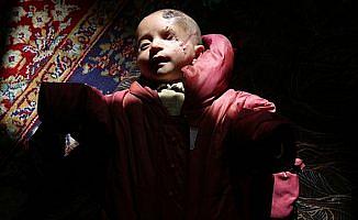 Doğu Gutalı öksüz bebeğin mucizevi direnişi sürüyor