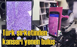 Türk Firmasından Kanseri Yenecek Teknoloji!