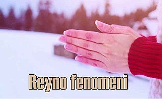 Soğuk havalardaki kabus: Reyno fenomeni