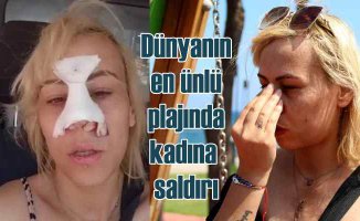 Antalya Konyaaltı Sahili'nde iki kadına saldırı