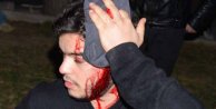 Suriye'deki kavgayı Konya'ya taşımışlar, 4 yaralı var