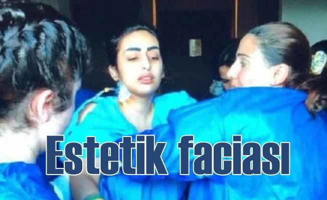 Estetik faciası; Çene estetiği genç kızın hayatın kararttı