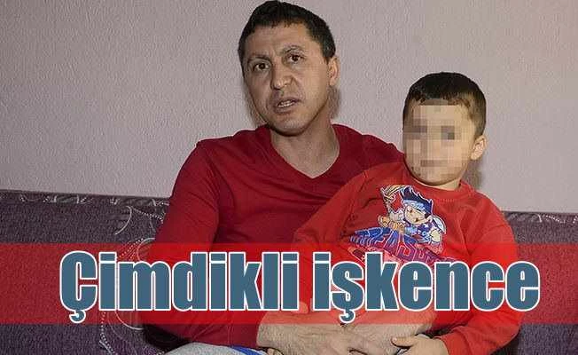 Otizmli küçük çocuğa kreşte çimdikli işkence