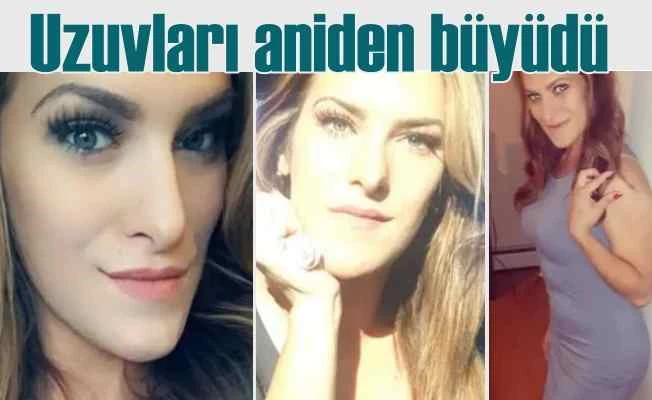 Genç kızın hayatı karardı | Orantısız büyüme hastalığı