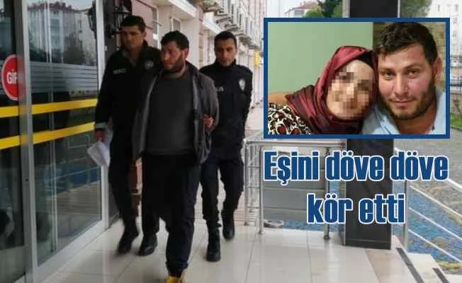 10 yıllık eşini tekme tokat döve döve kör etti