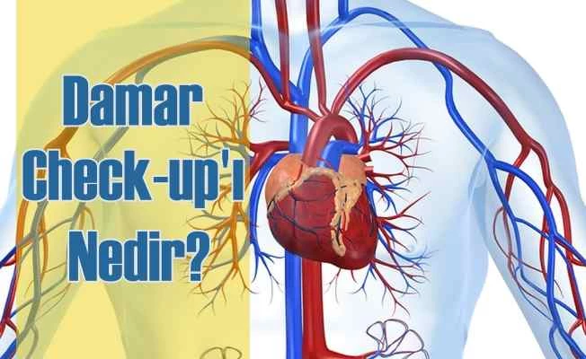 Damar Check-up'ı Nedir?