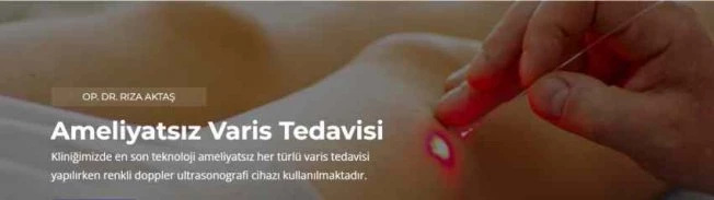 İzmir Varis Tedavisi