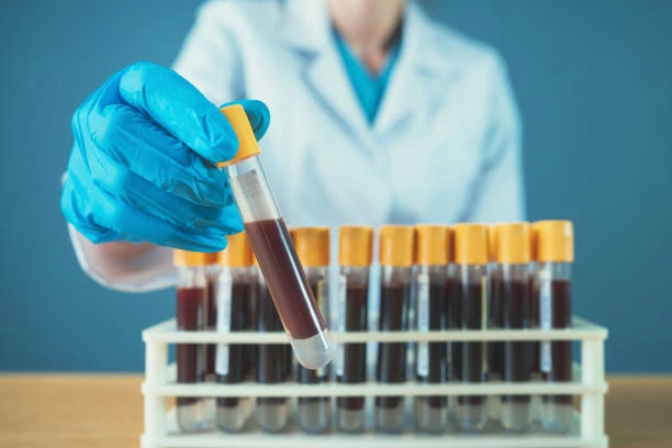 Coolermed: Medikal Soğutma Ekipmanları ve Kan Dolabı Modelleri