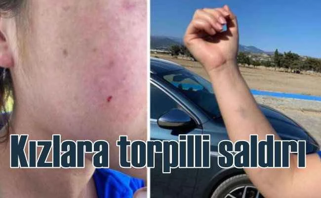 Magandalardan, yolda yürüyen kadınlara torpilli saldırı